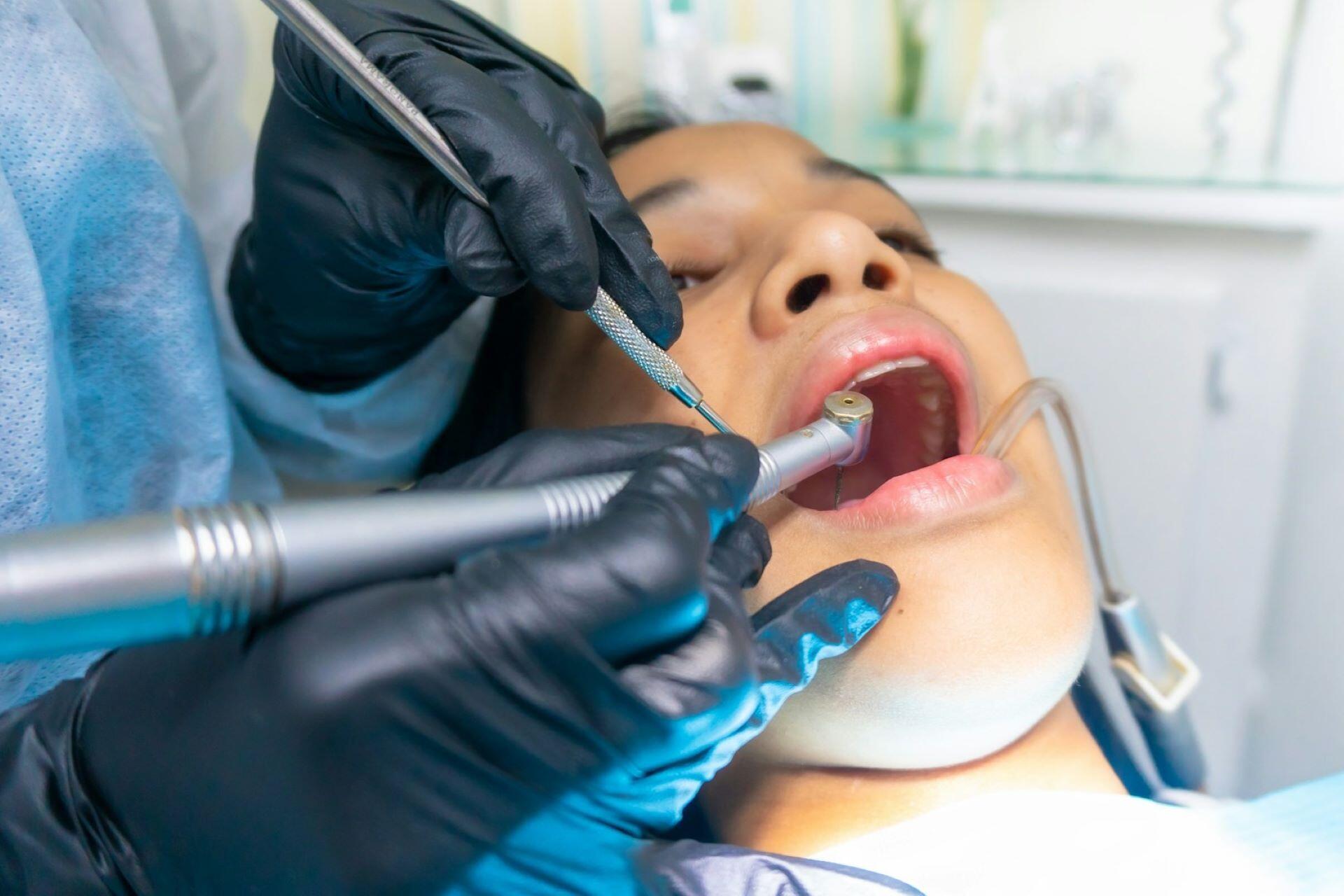 A dental professional using instruments during a dental procedure