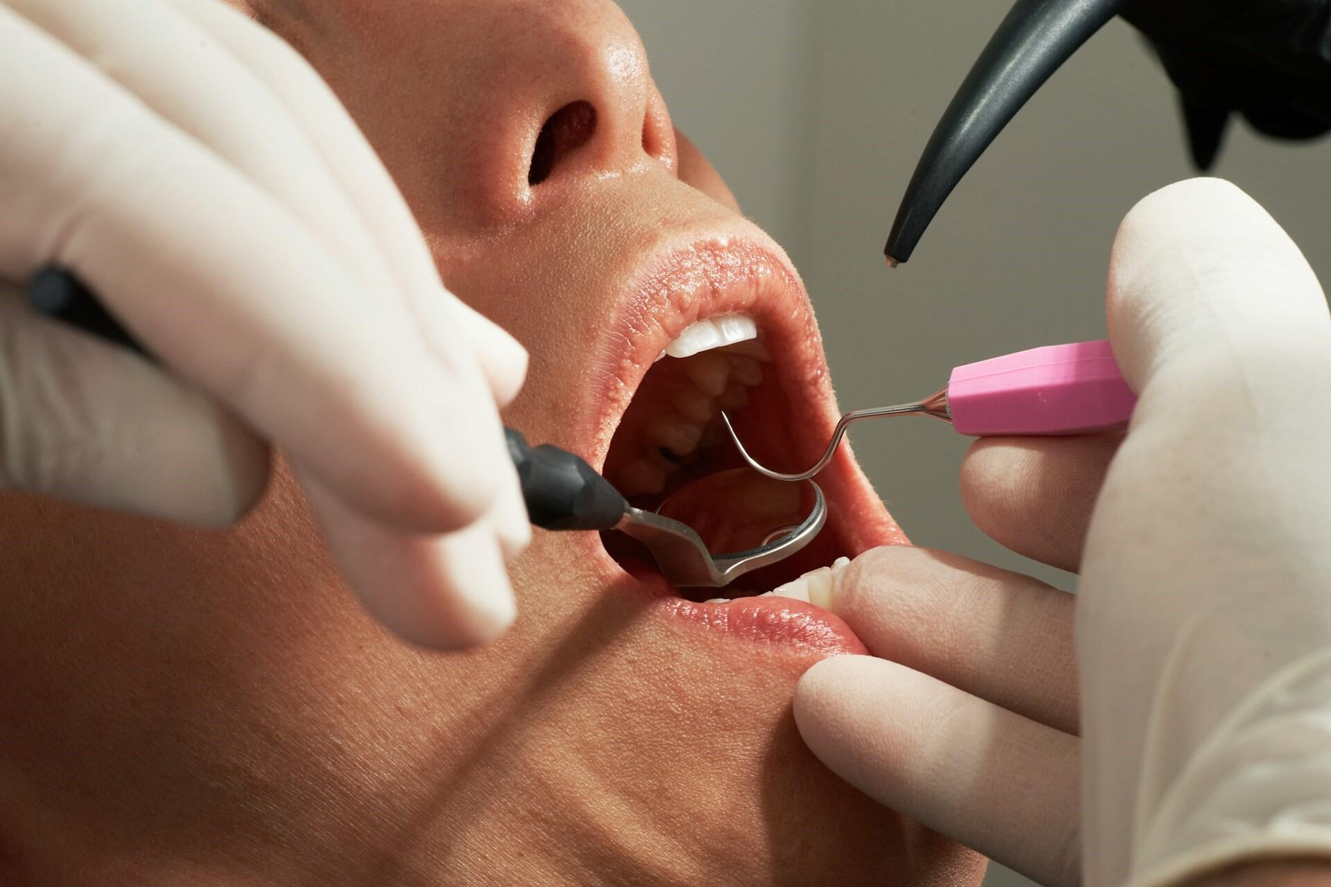 Dental tools being used during an oral examination