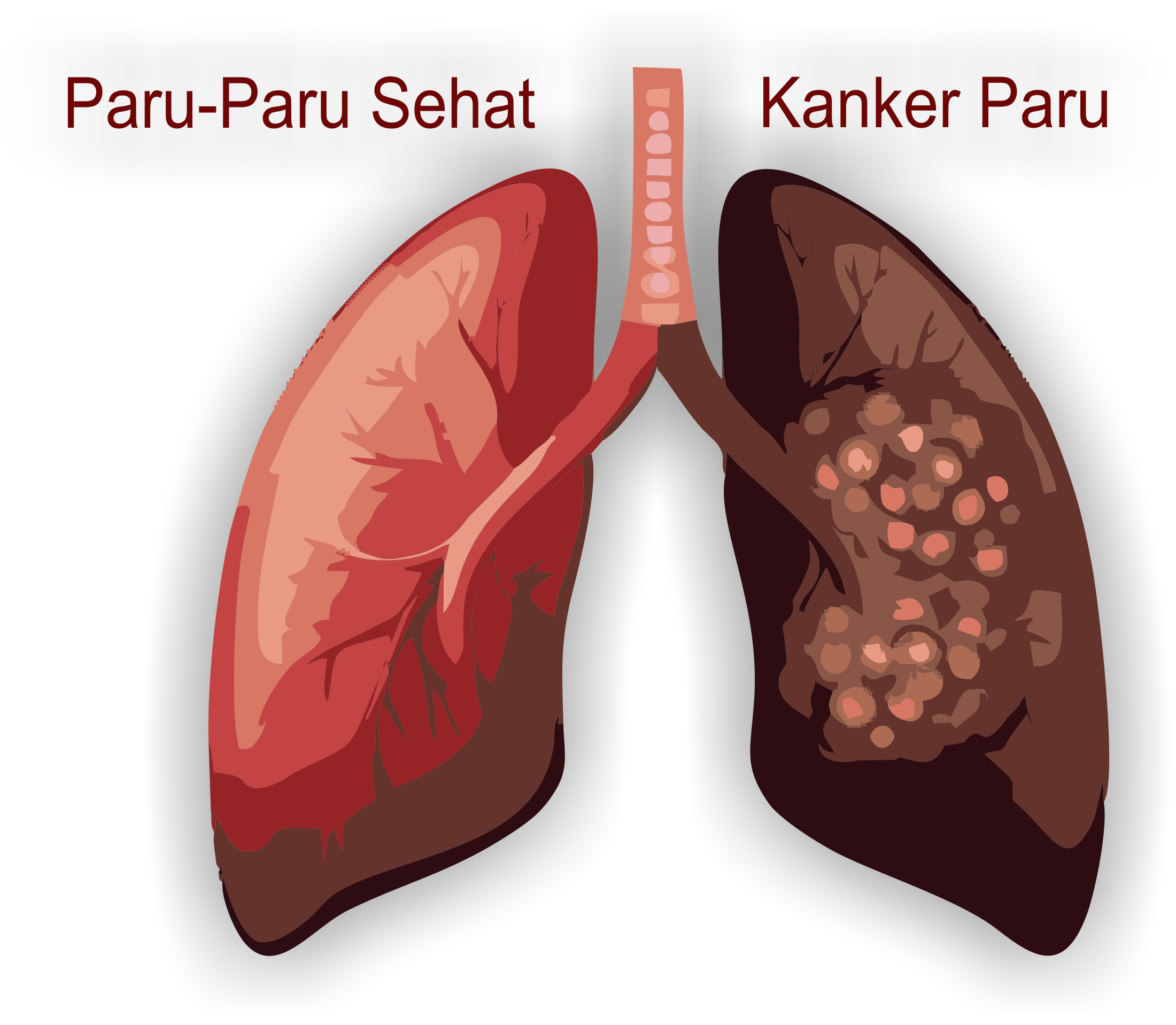 Pola makan