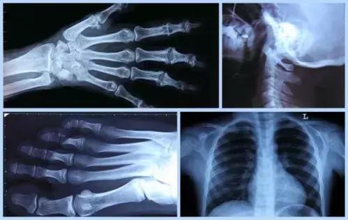 La radiologia e tutto il settore medico sono debitori di formule e concetti matematici