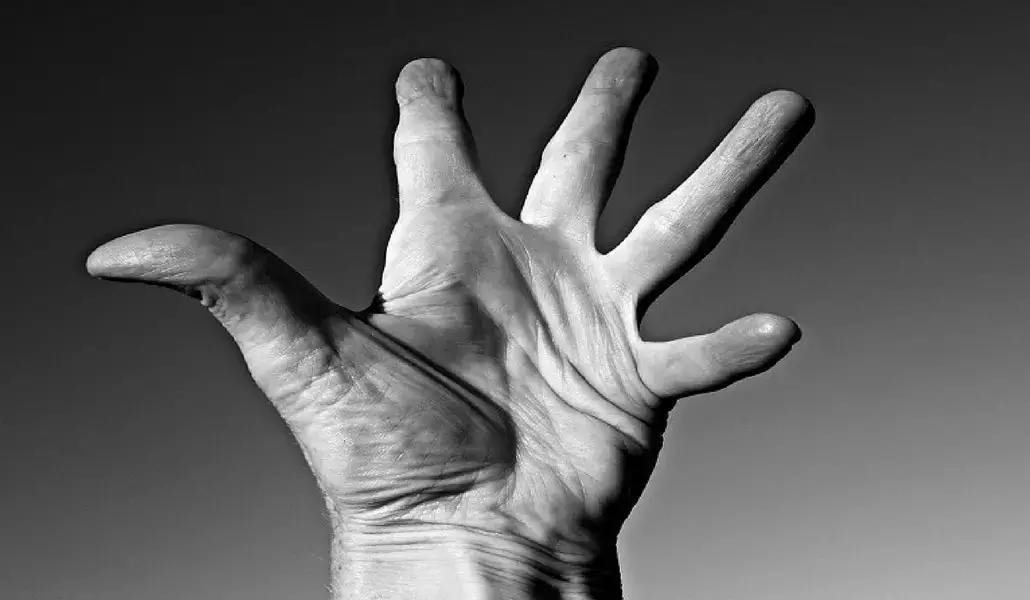 In che modo è possibile continuare lo yoga con l'artrosi?