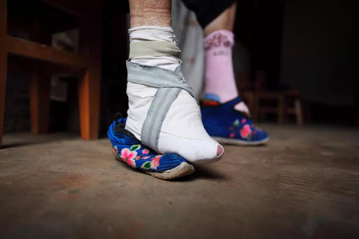 Una tradizione secolare che deturpa i piedi delle donne, per una presunta maggiore eleganza del portamento ...!