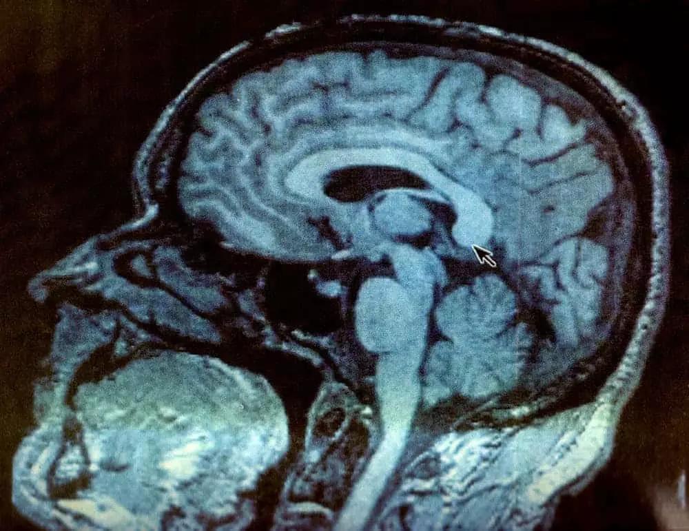 La ritmica di un brano con la chitarra si può acquisire.