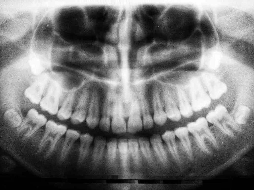 Un foniatra saprà diagnosticare correttamente l’origine del tuo problema e prescriverti la cura corretta.