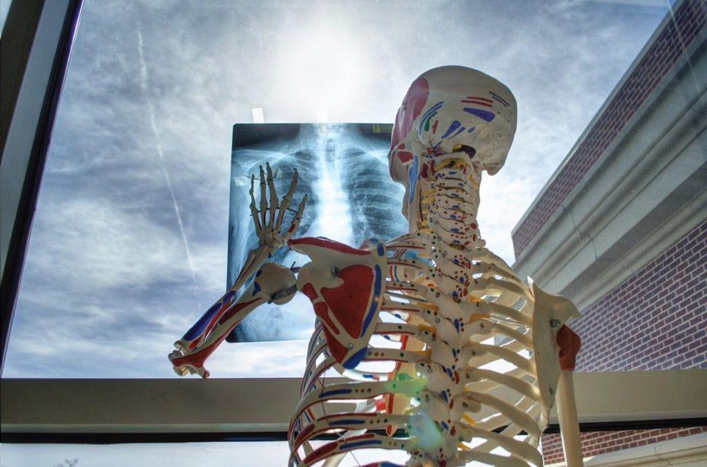 Grazie all'opera di Marie Curie i raggi X furono impiegati negli ospedali.