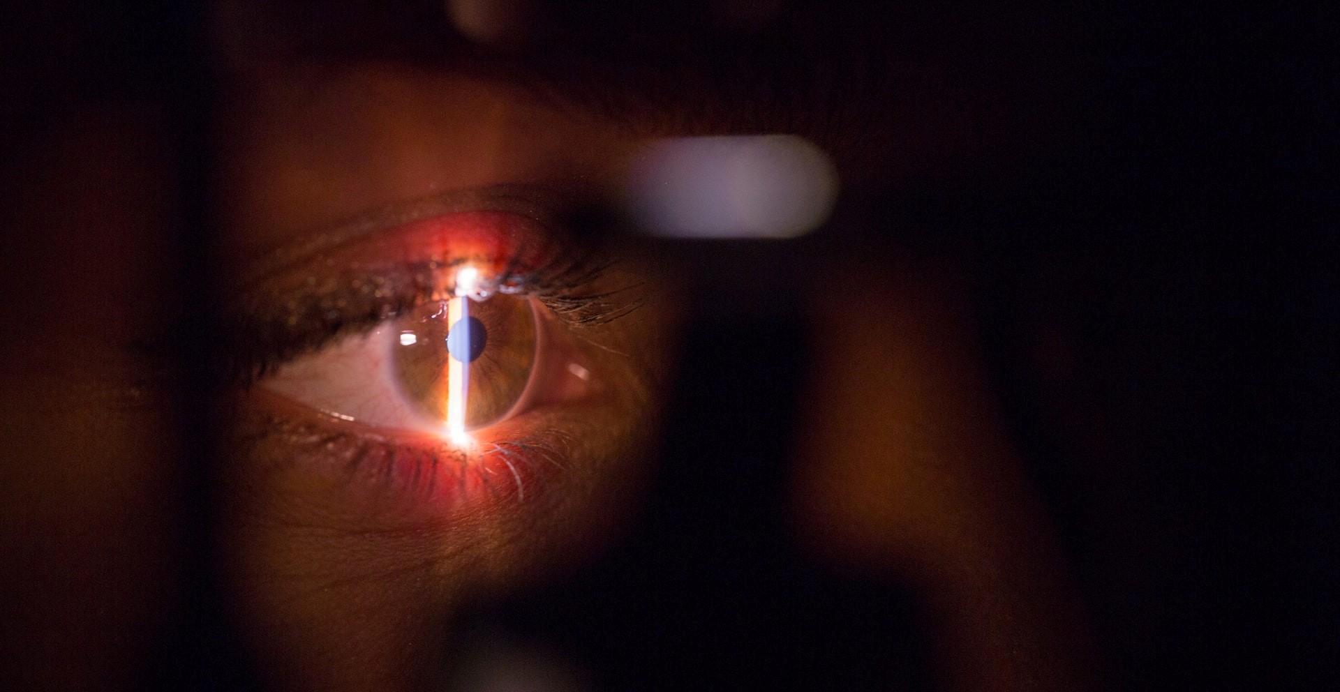 optique laser physique oeil