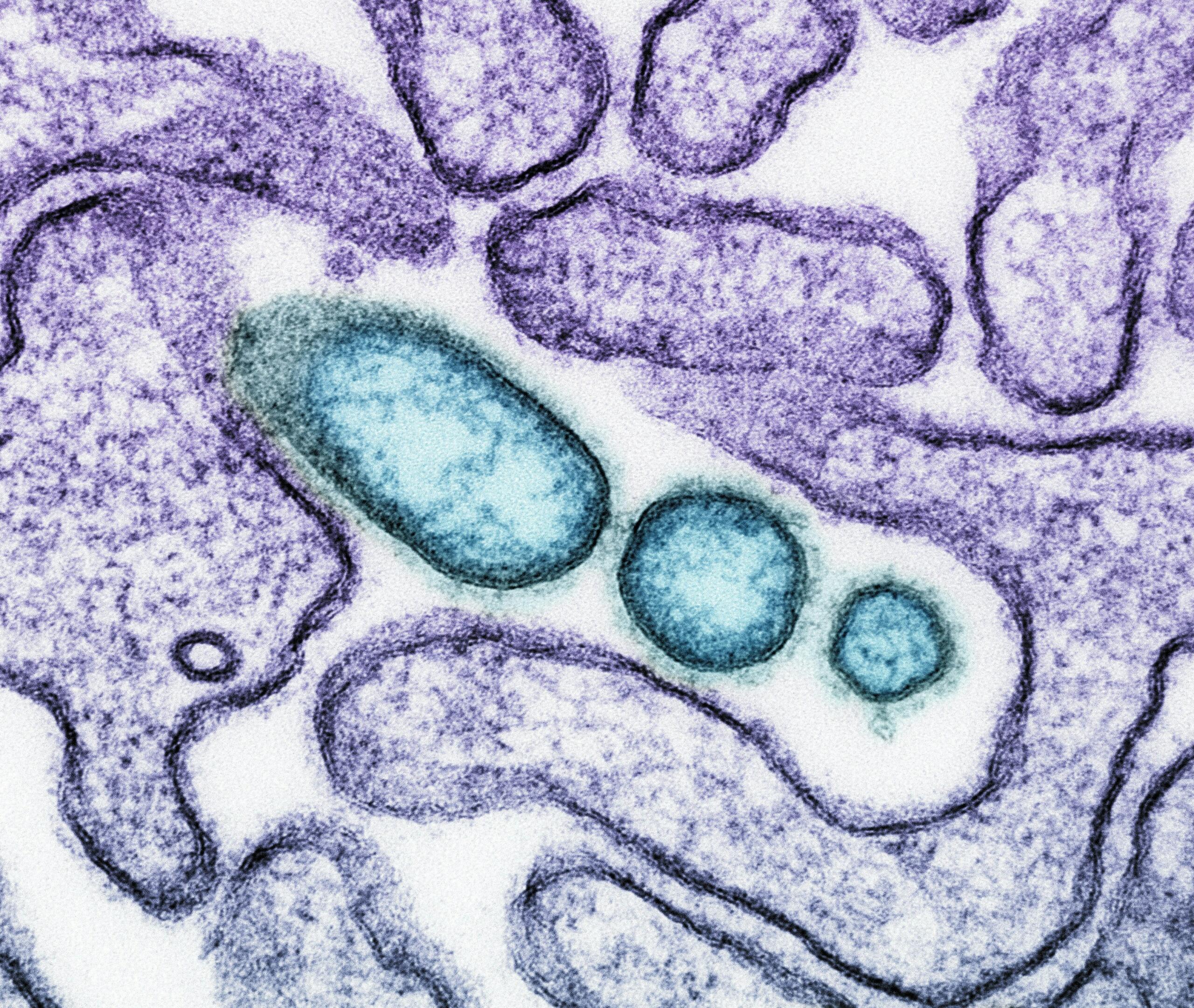 Trīs iegarenas, zilganzaļas Nipah vīrusa daļiņas.
