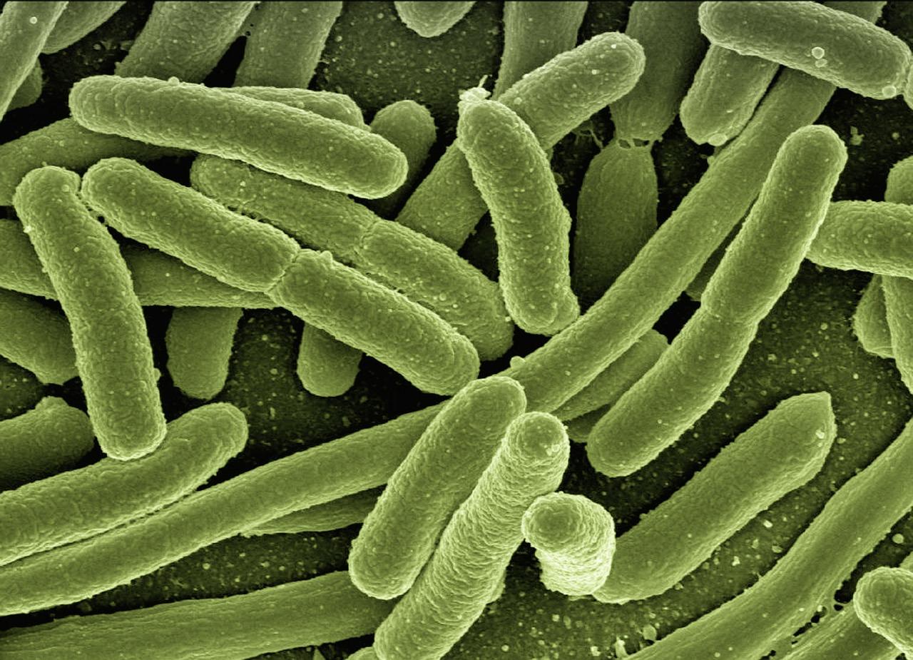 Een infectie kan woorden veroorzaakt door een bacterie, virus of ander actor