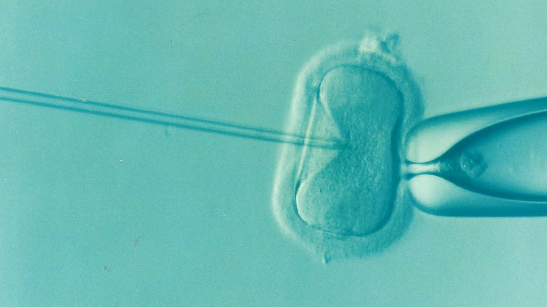 IVF is een van de grootste ontdekkingen geweest in de biologie