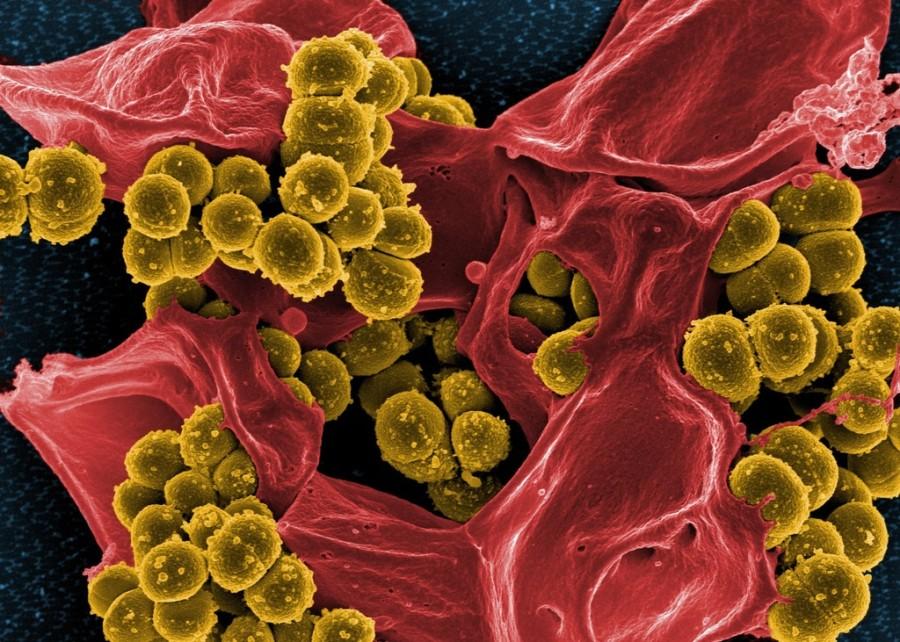 microscoop opname van plant met stuifmeelkorrels