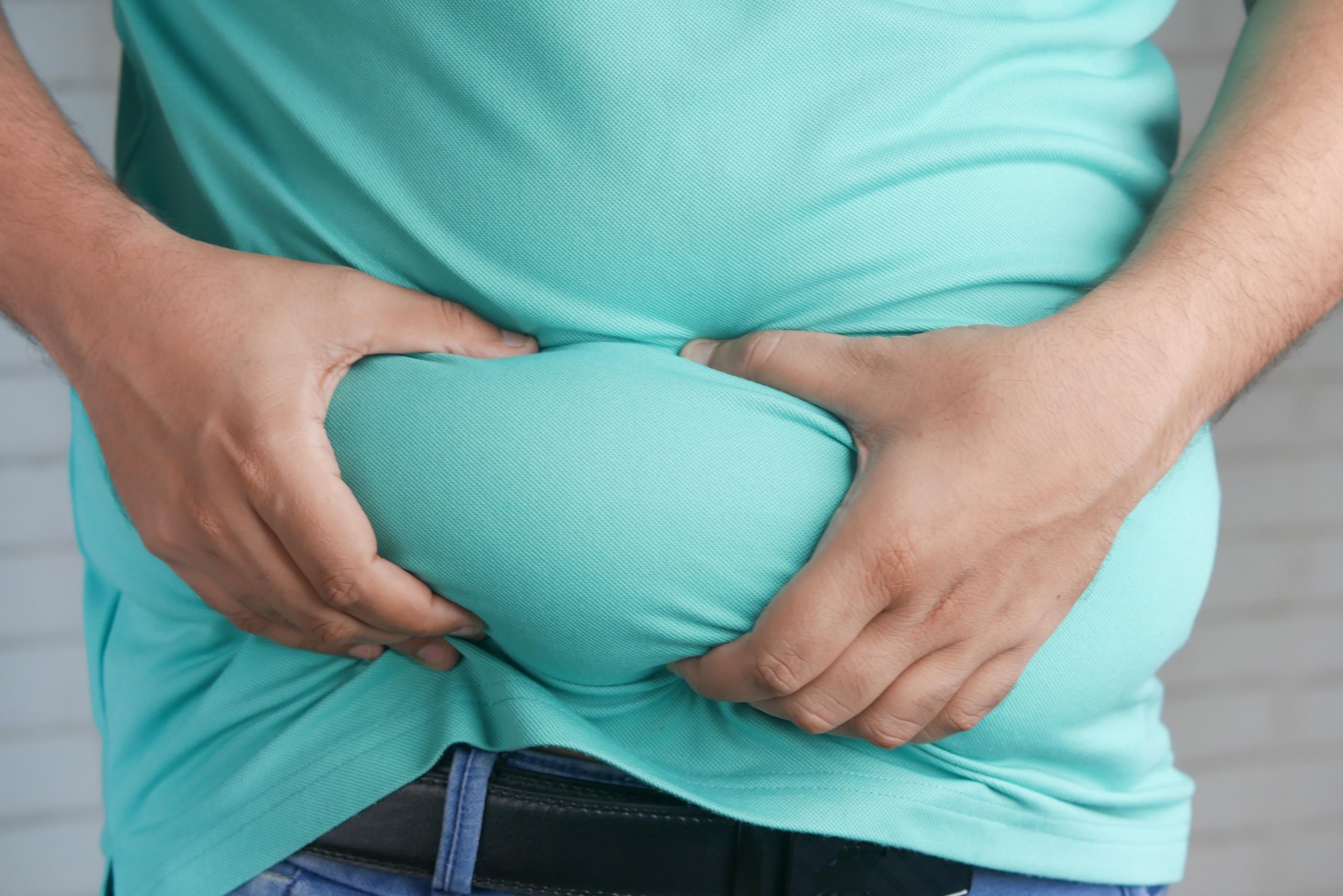 Obesitas in Nederland
