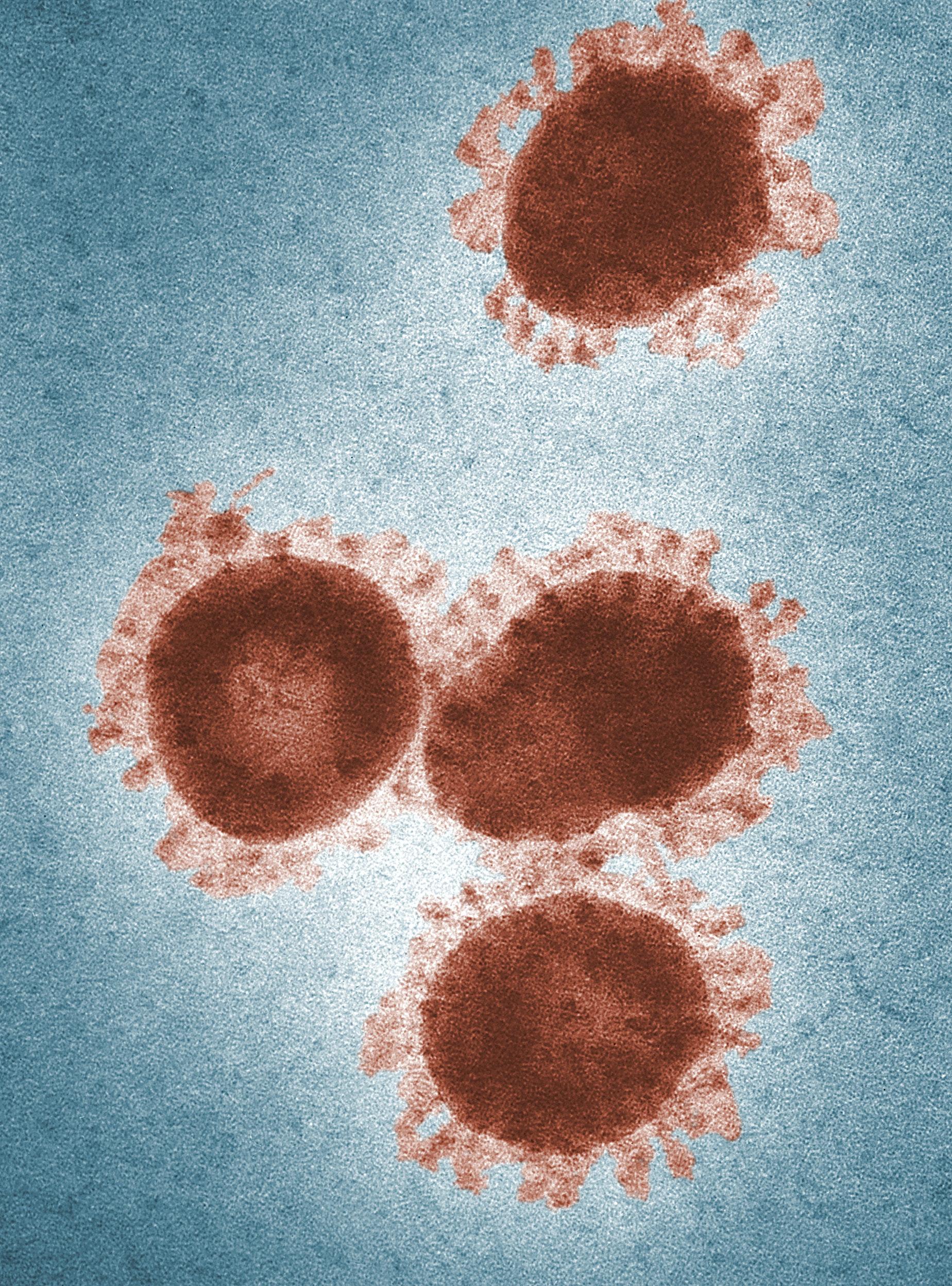 Microscopic levels 