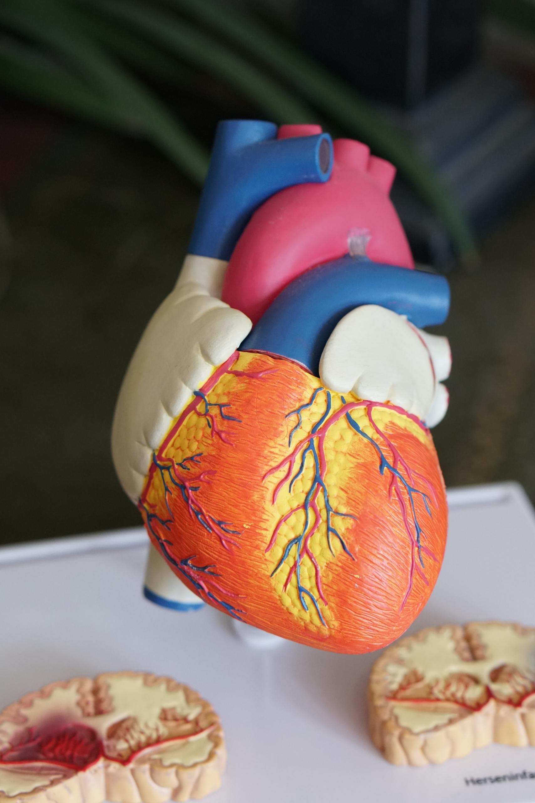 A diagram of a heart