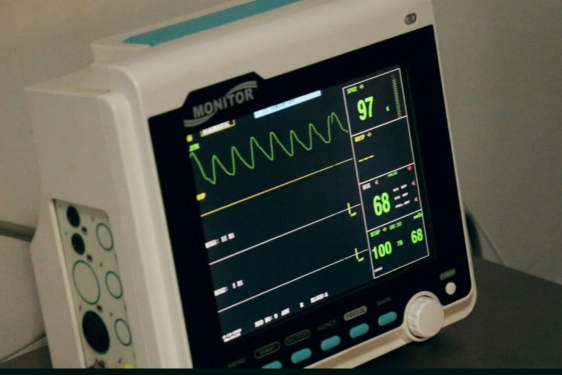 An electrocardiogram.