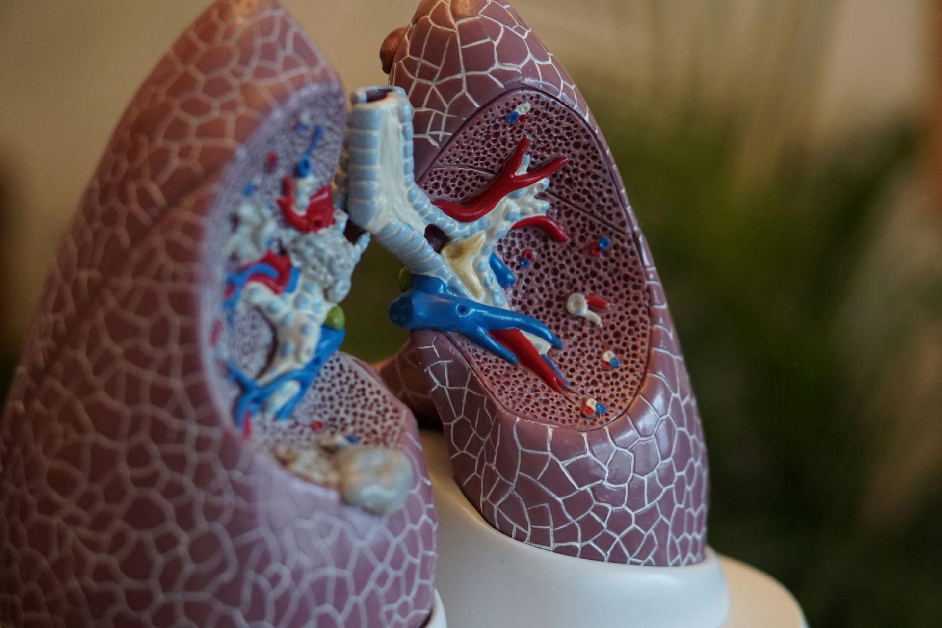 A model of human lungs.