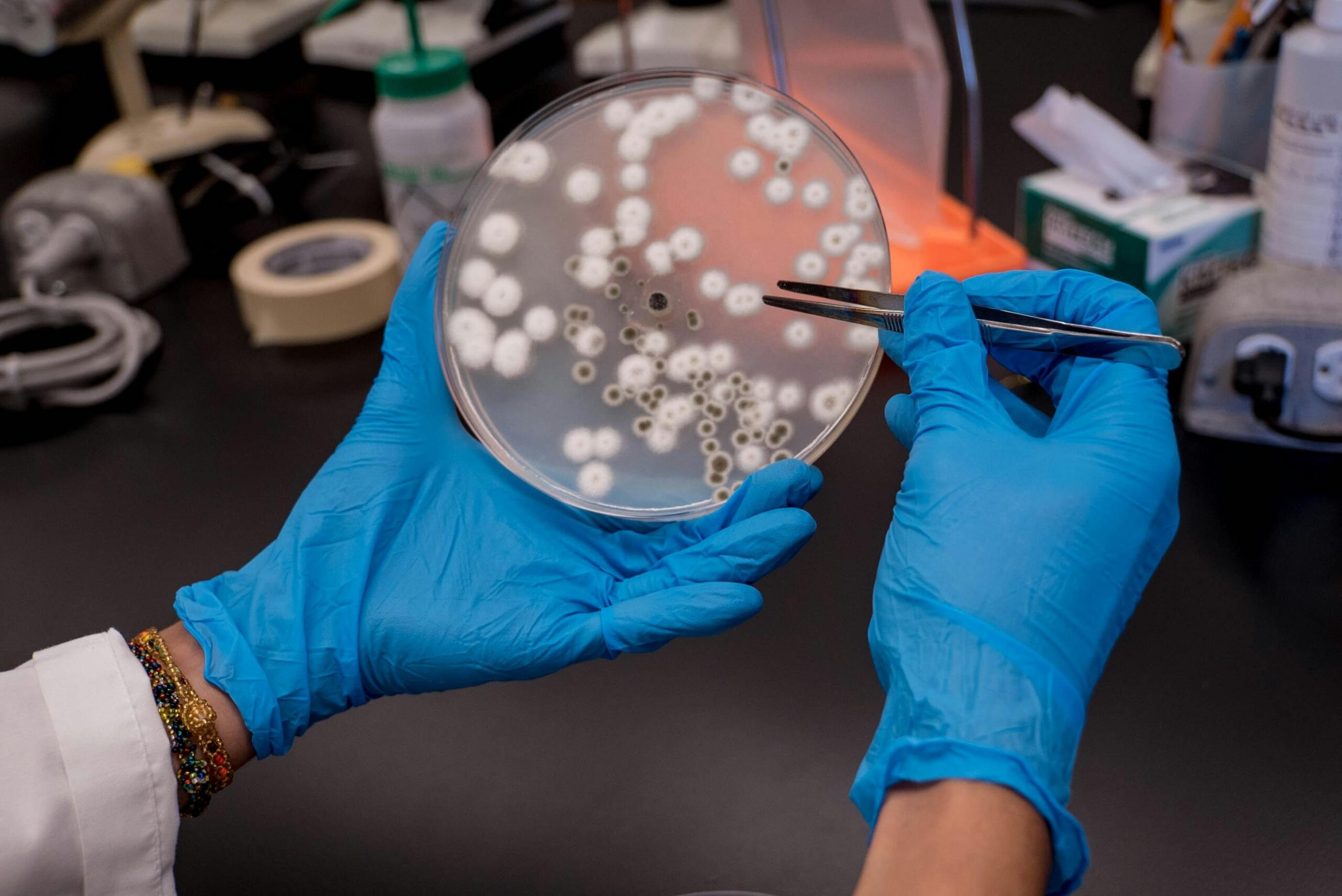 Manos con guantes examinando una placa de Petri con cultivos en microbiología.