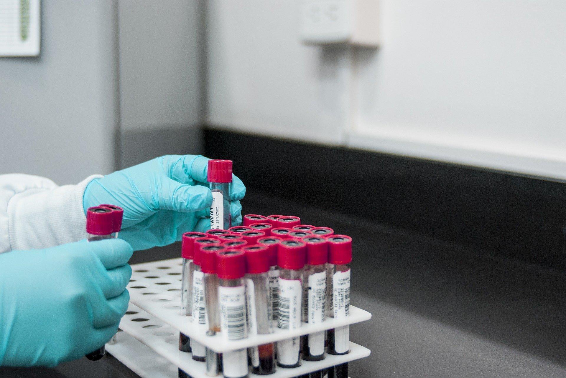 A físico quimica não precisa de ser uma disciplina que parece o latim