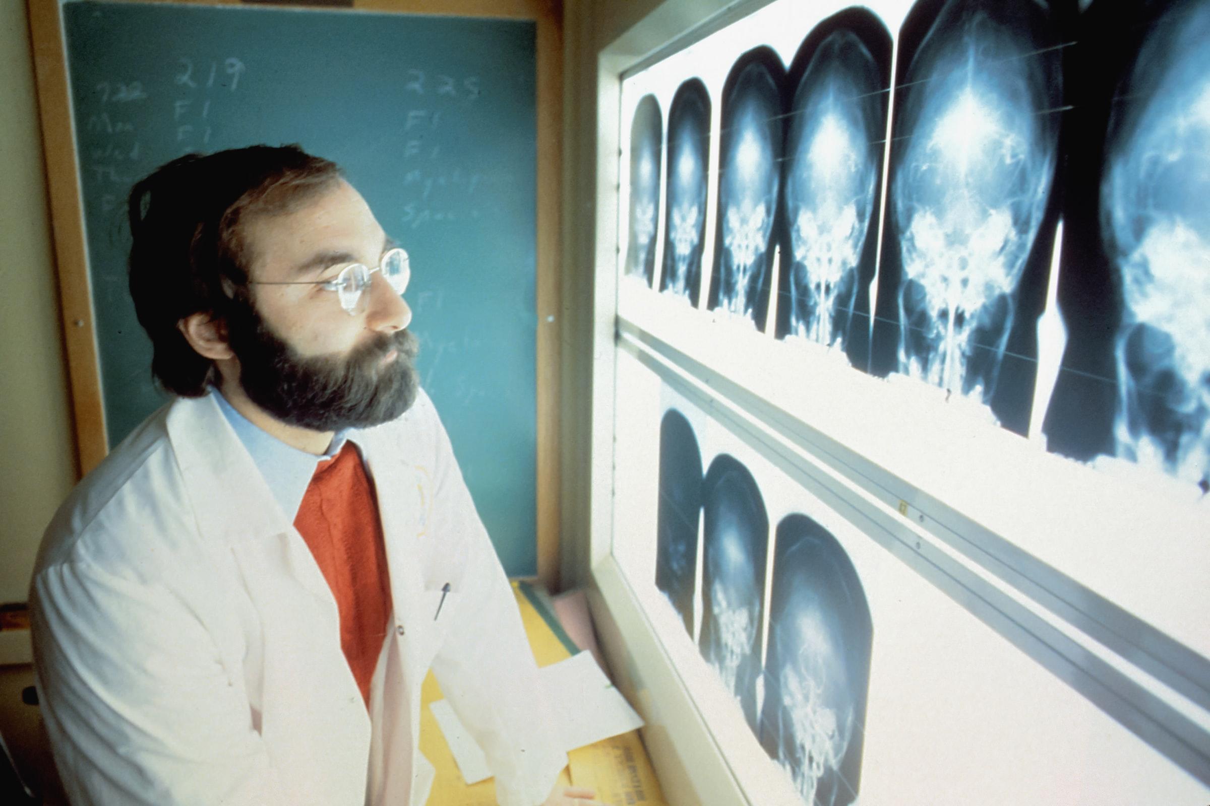 Homem a olhar para vários radiografias