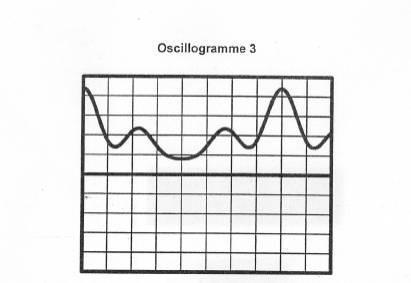 Comment régler un oscillateur ?
