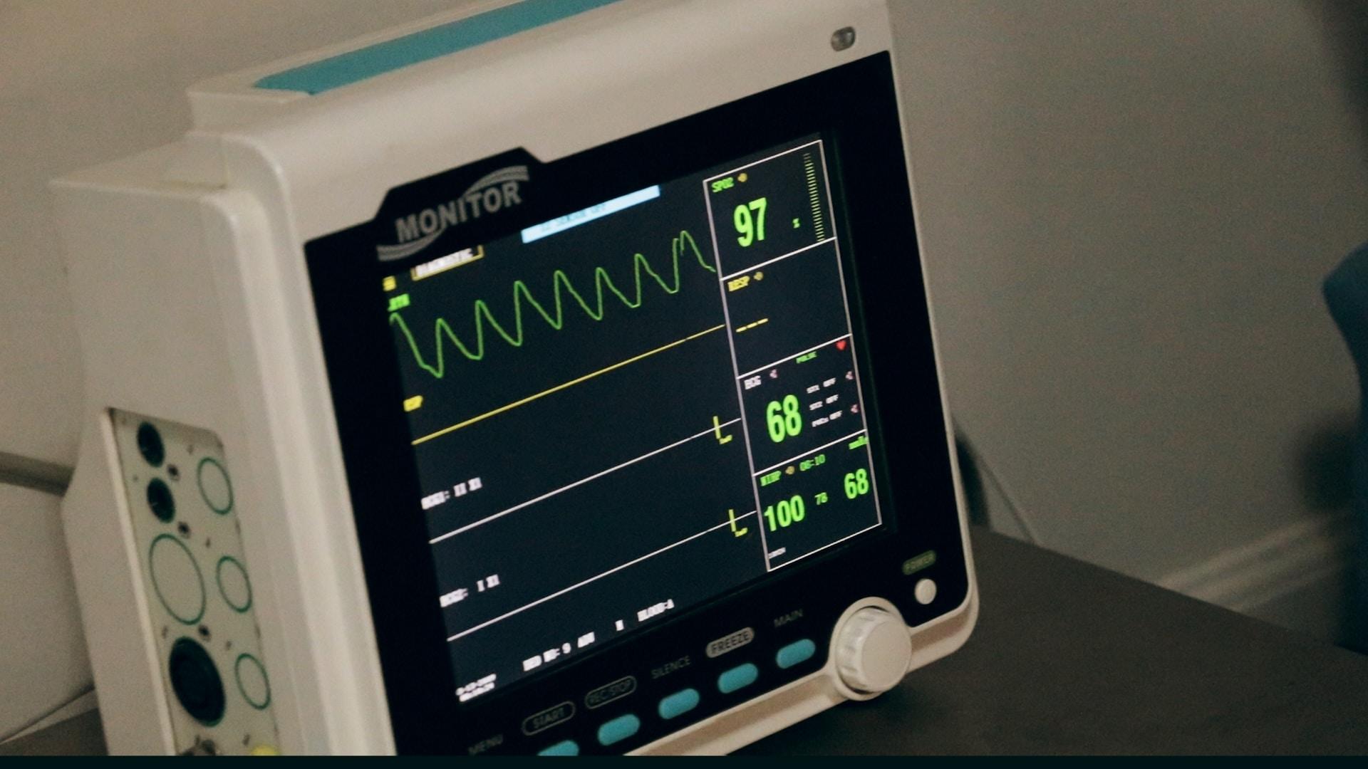 électrocardiogramme pour mesurer les battements du coeur