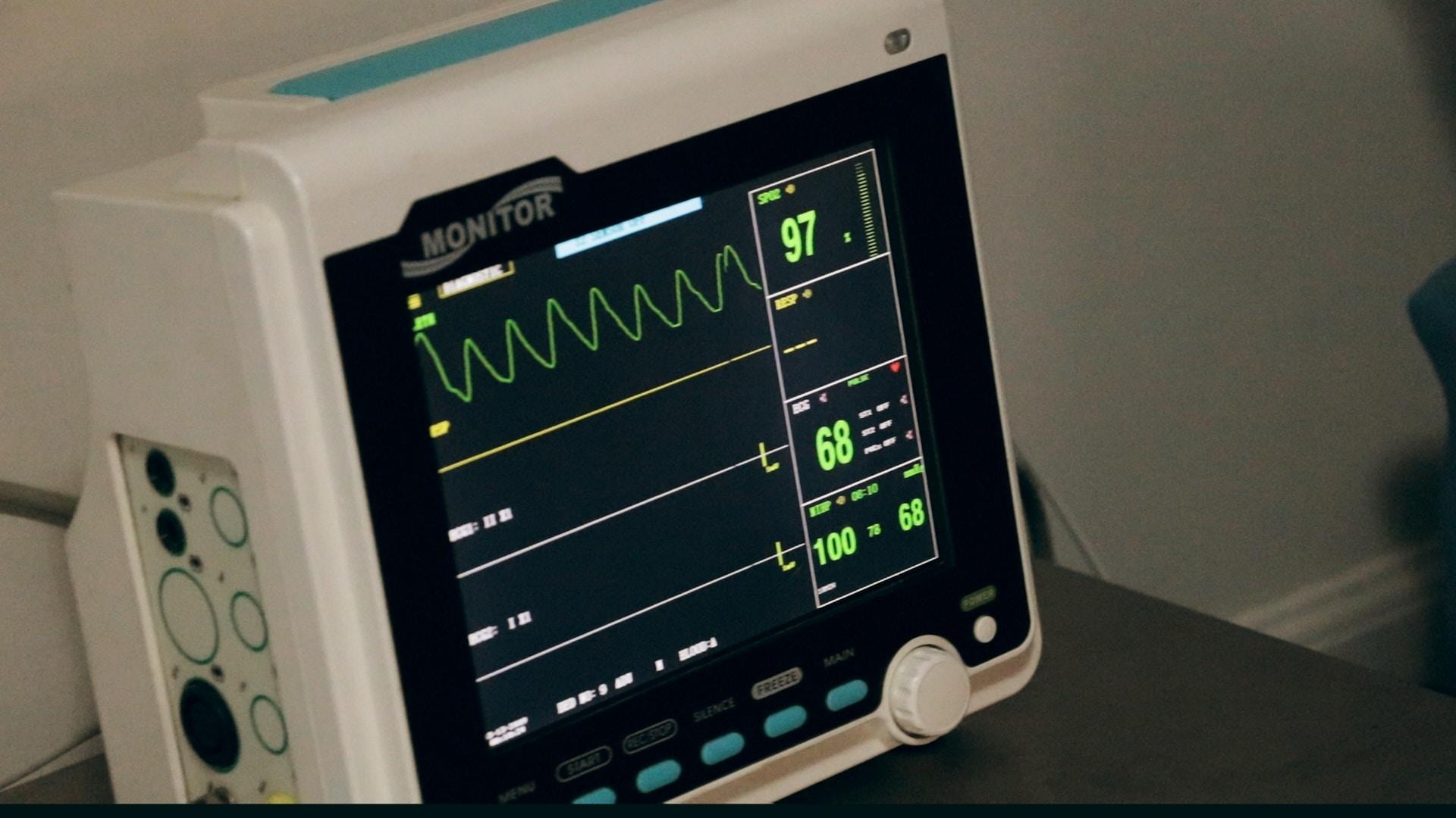 électrocardiogramme pour mesurer les battements du coeur 