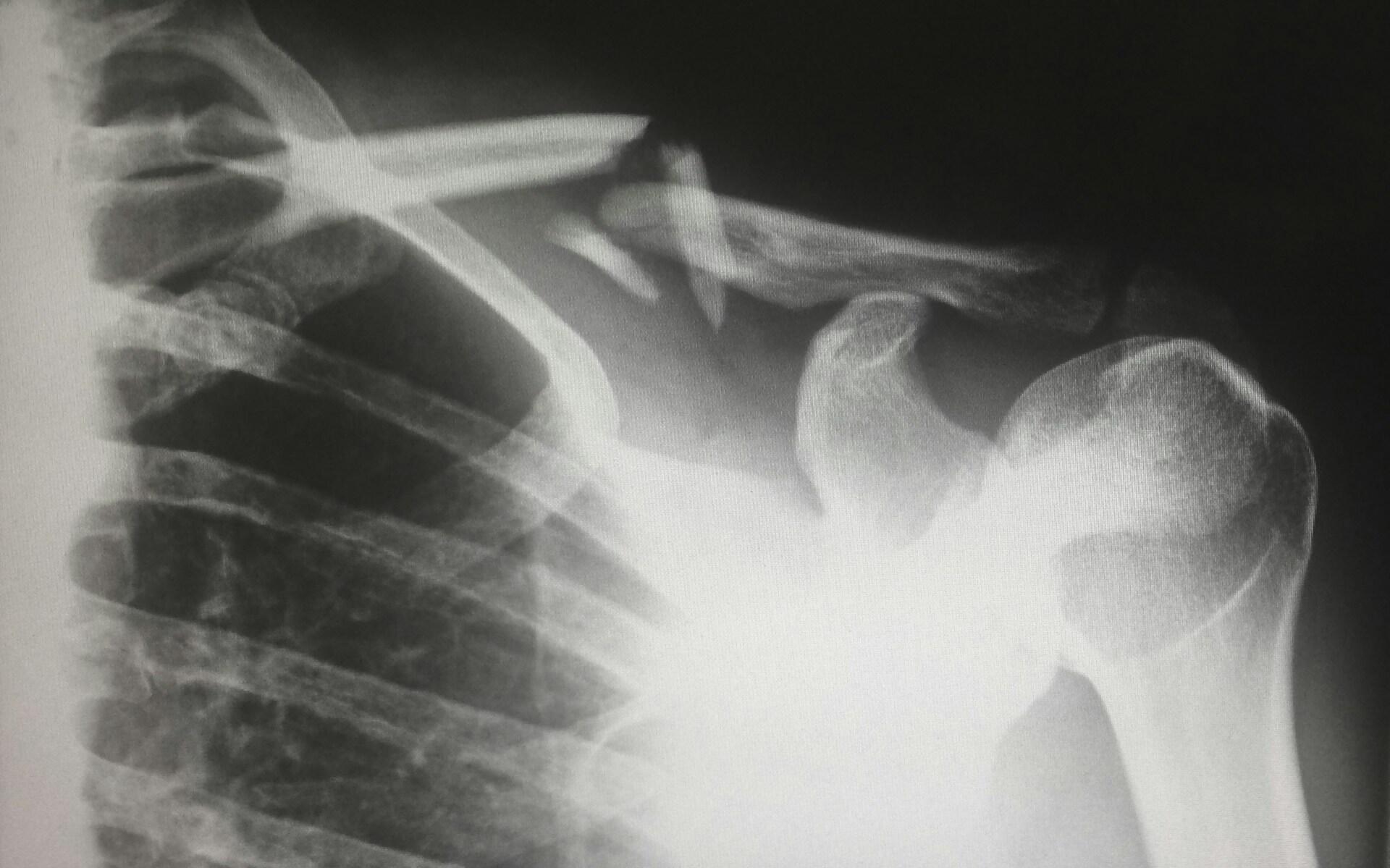 x-ray deki insan iskeleti görüntüsü