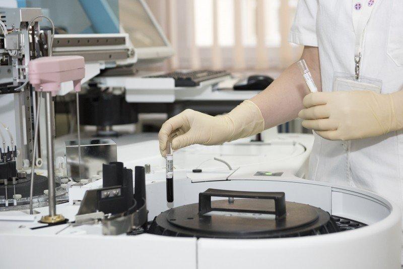 Doctor preparing lab material for a test.