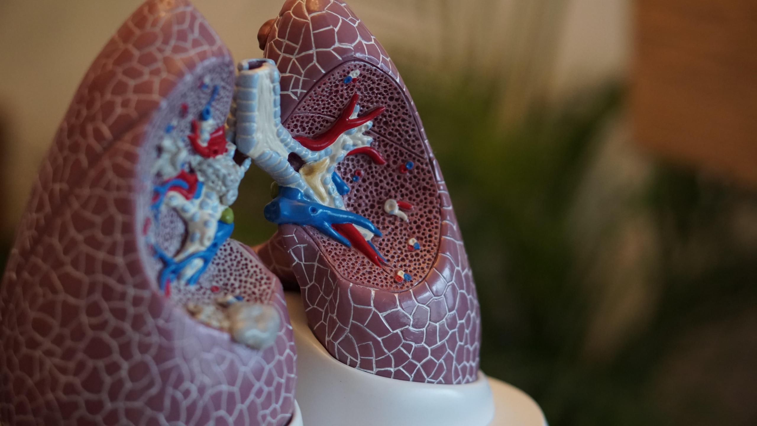 A 3D model of a human lung.