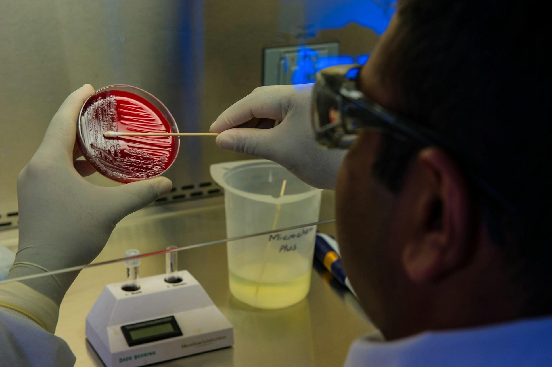 A person preparing some foodborne bacteria.