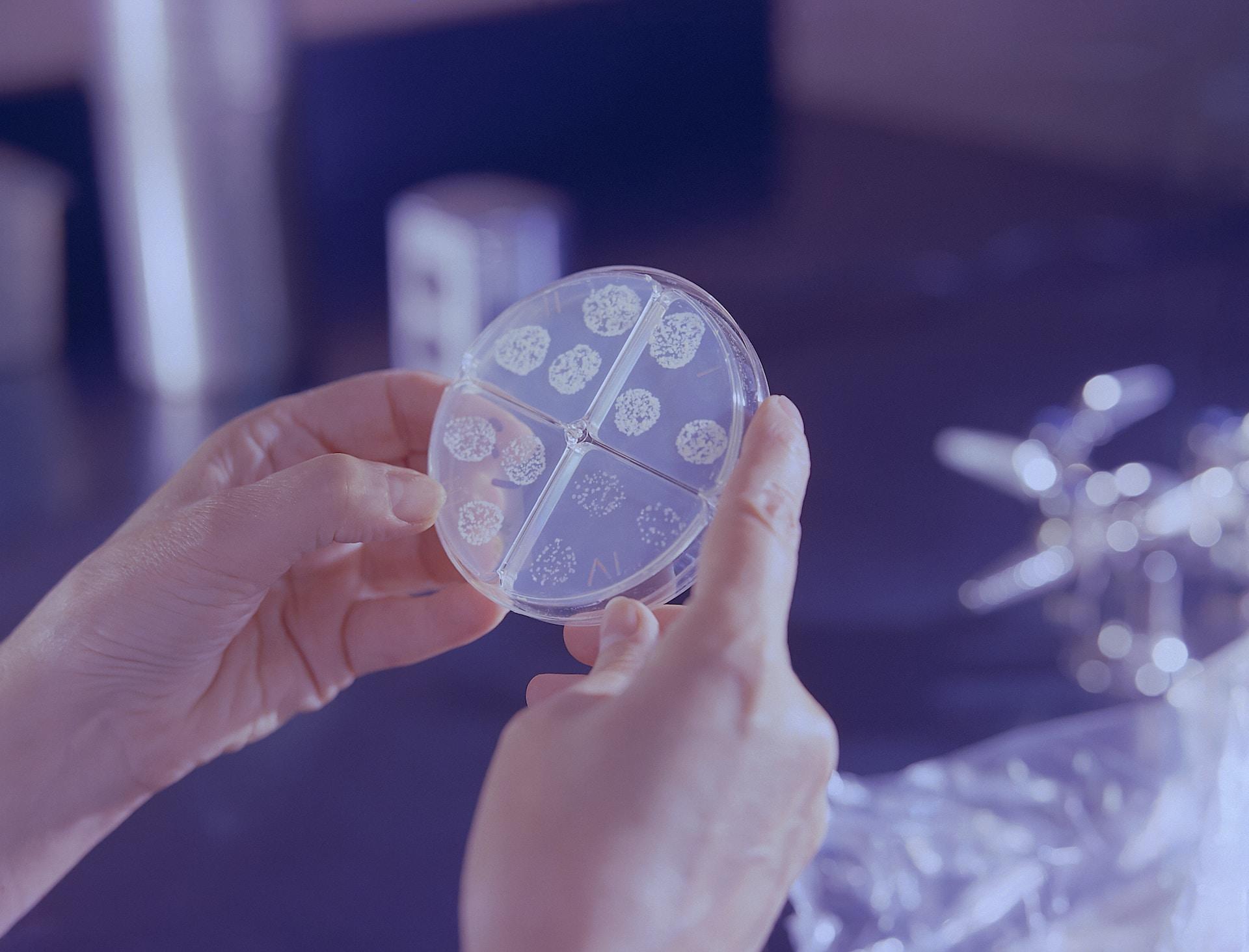 A petri dish with different bacterial cultures on it.