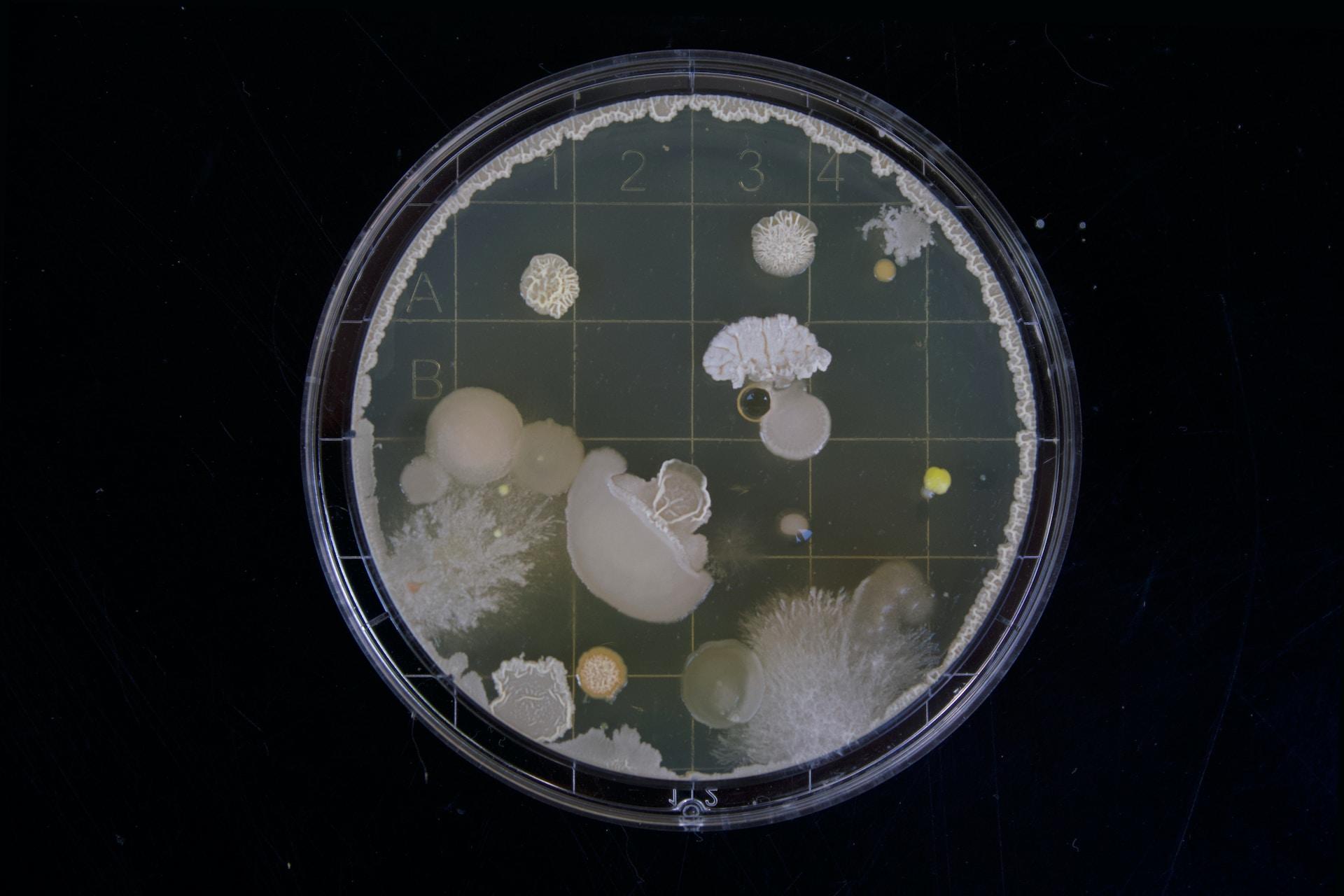 A Petri dish with a bacterial culture inside.