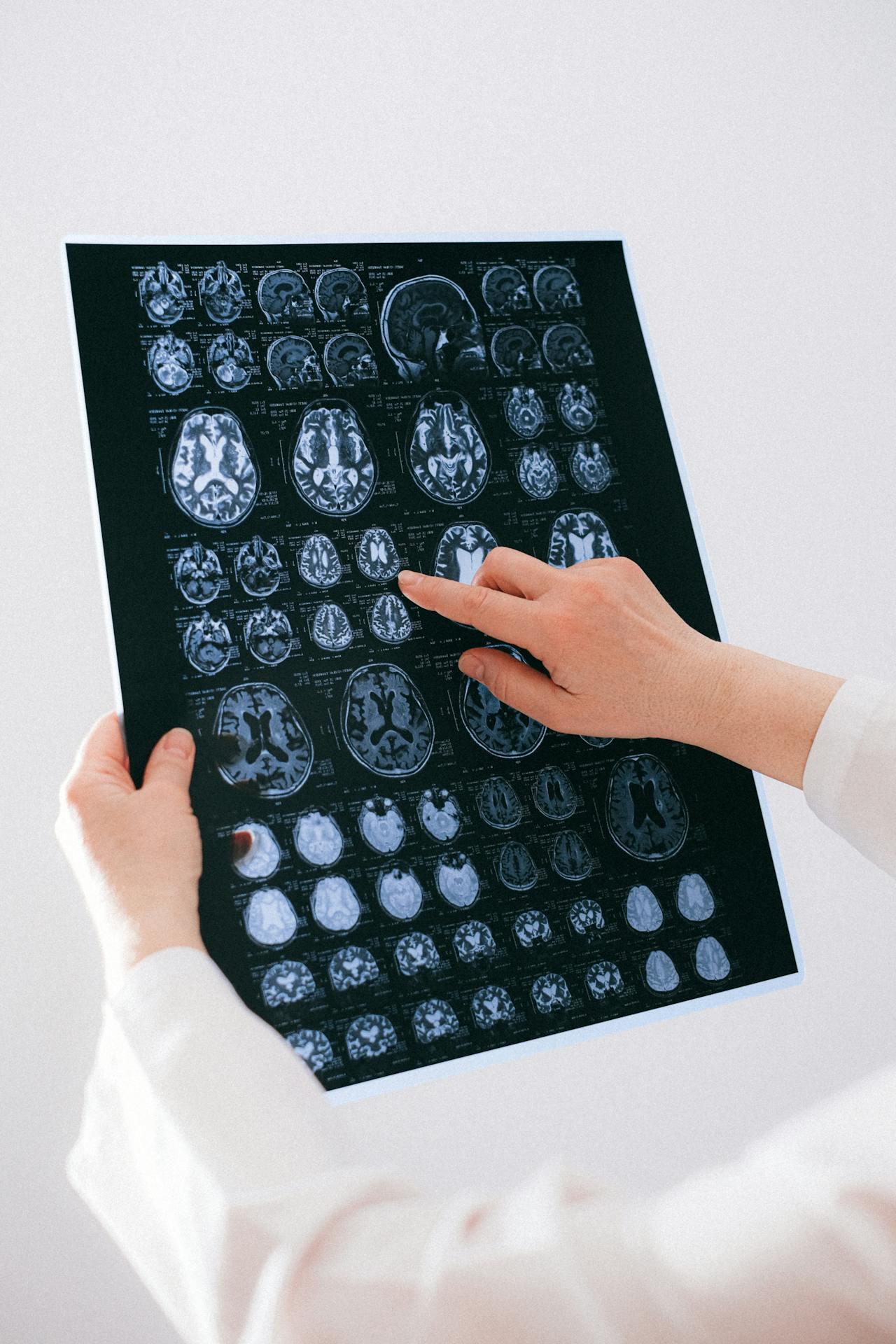 Scans and MRIs of a patient in a medical setting