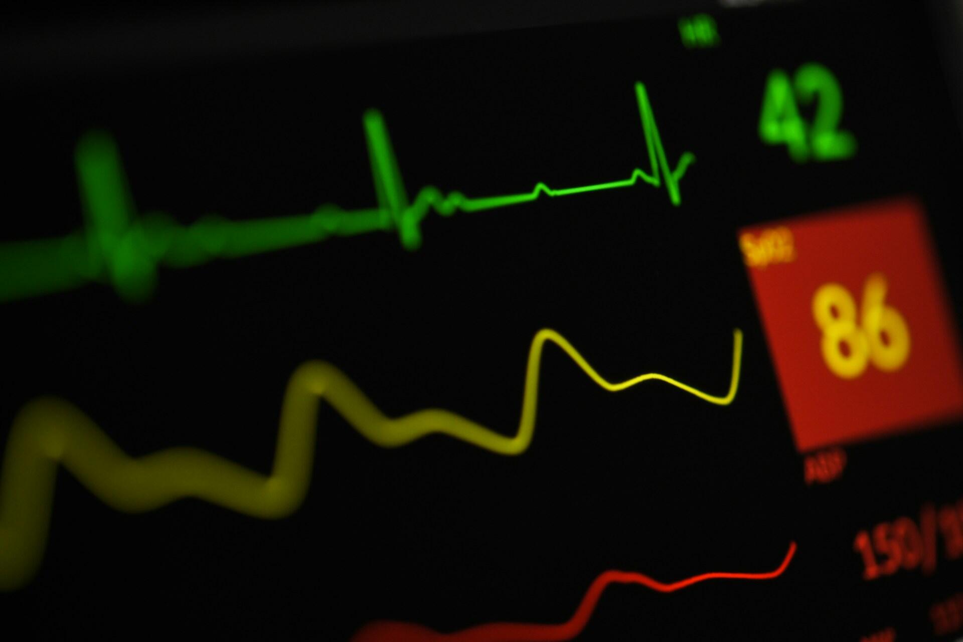 A patient's heart monitor.
