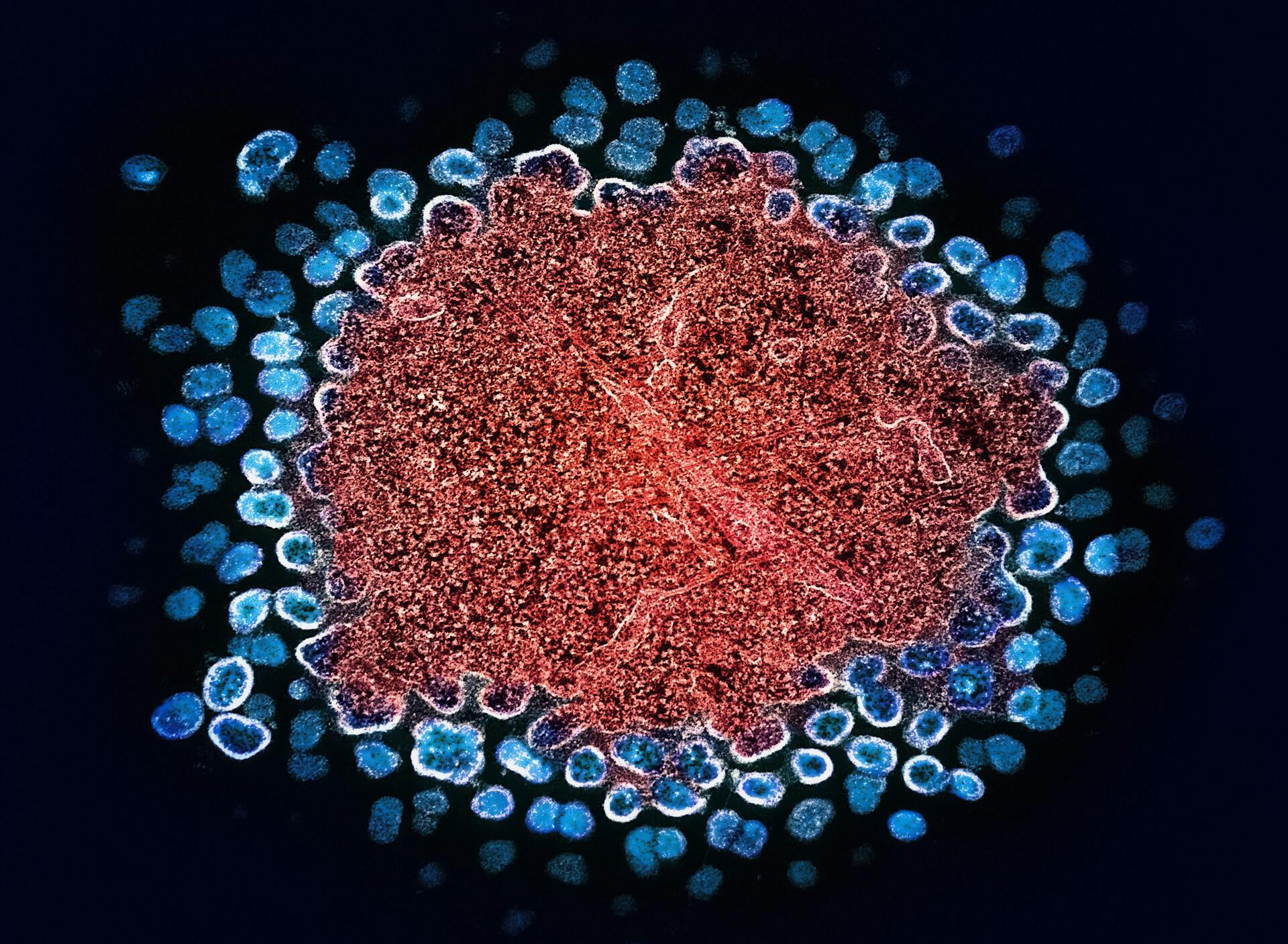 Imagen de un microorganismo