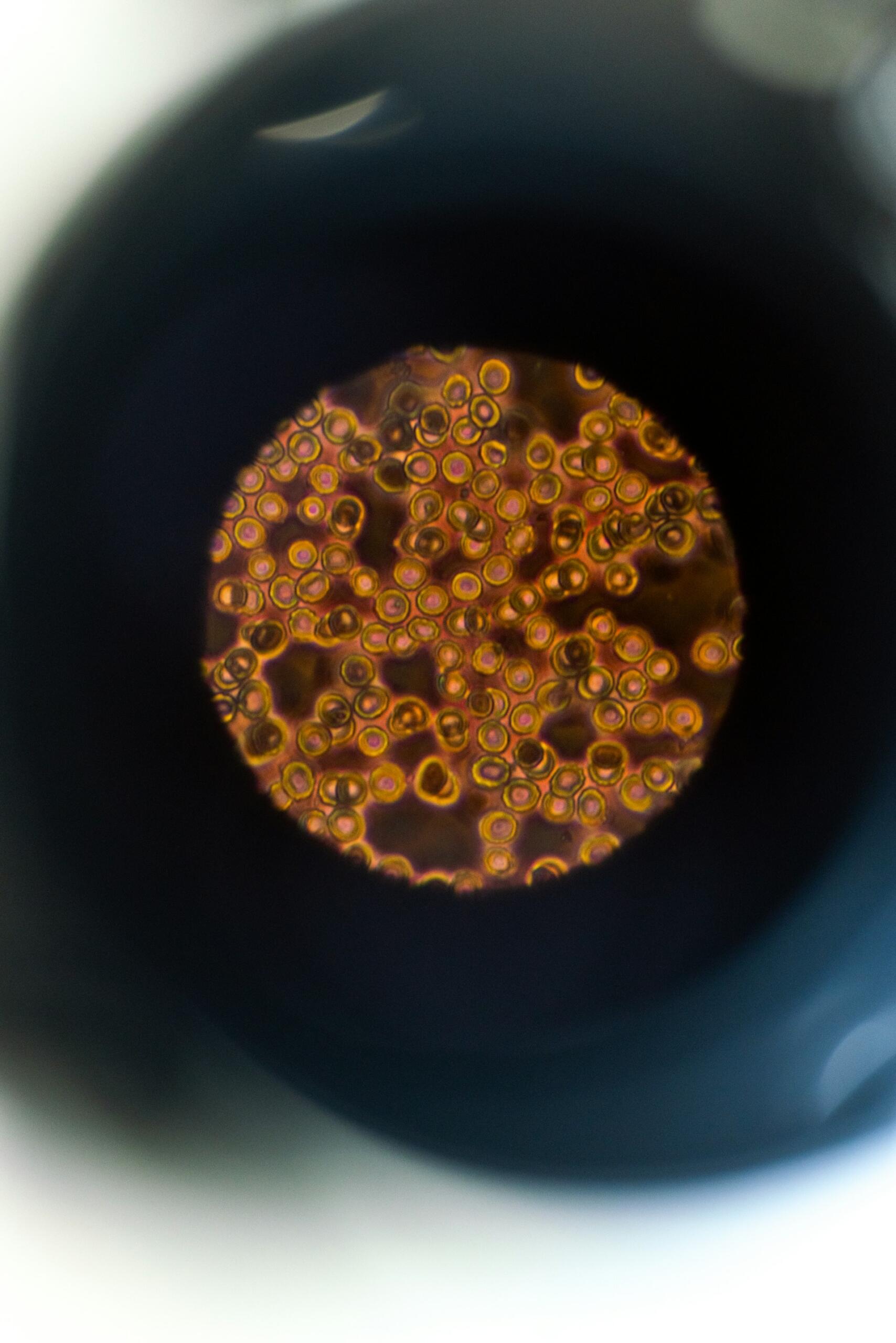 Imagen del organismo desde un microscopio